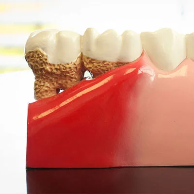 Gum disease treatment Powder Springs
