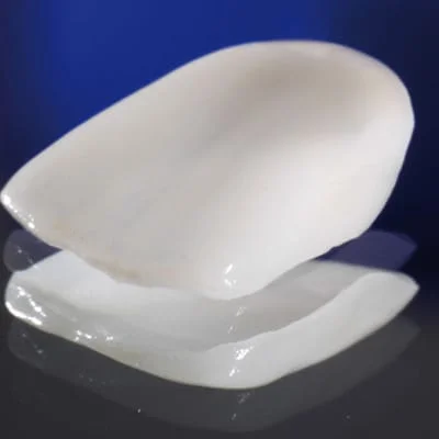 Very thin porcelain veneers
