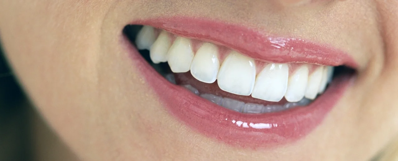 whiteteeth1.jpg
