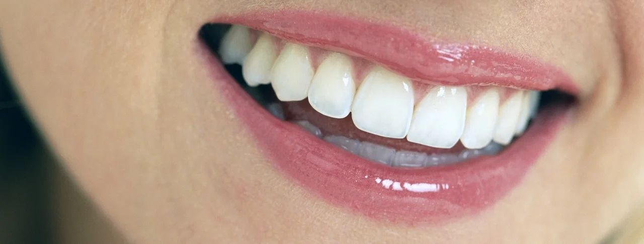 whiteteeth1.jpg