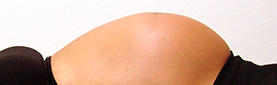 Caesarean-After-Hospital.jpg