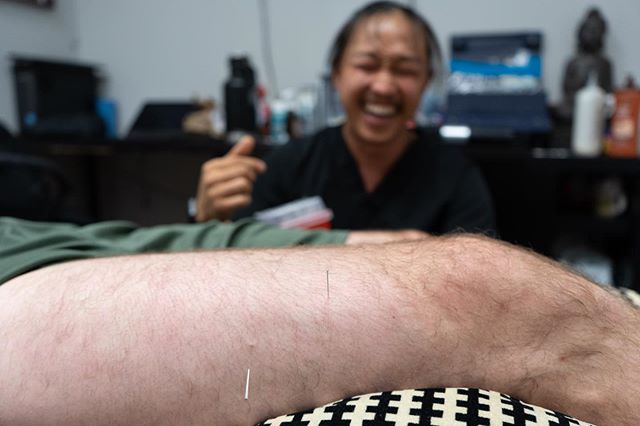 Only @dr_gersh could make needles look this fun 😂
.
.
Dry needling helps with a countless number of issues in the muscle and can penetrate even deeper with the help of stem.