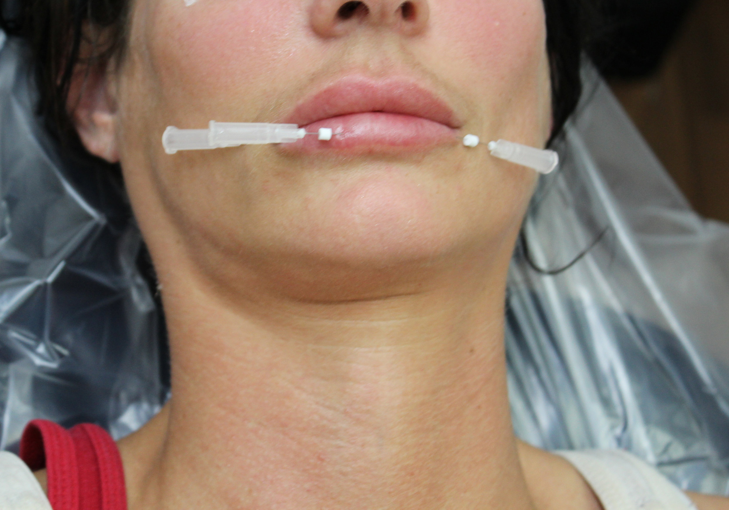 Lipthread2.jpg