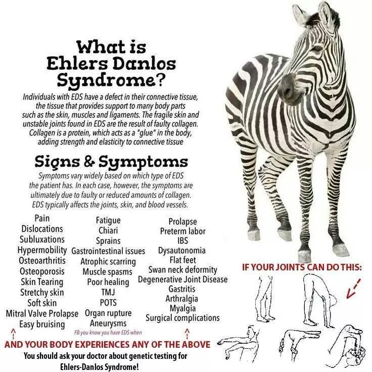 POTS? Ehler's Danlos Syndrome?