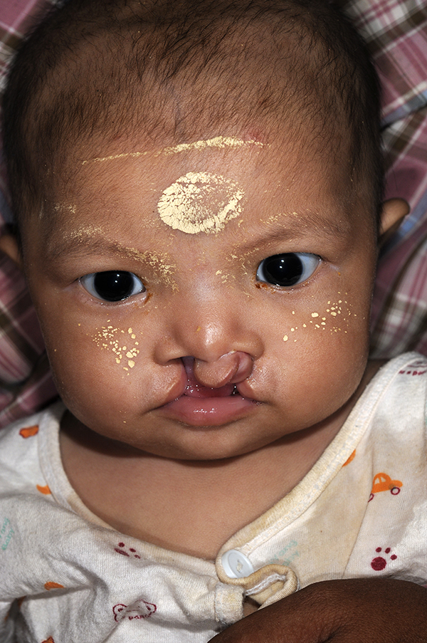 child-myanmar.jpg