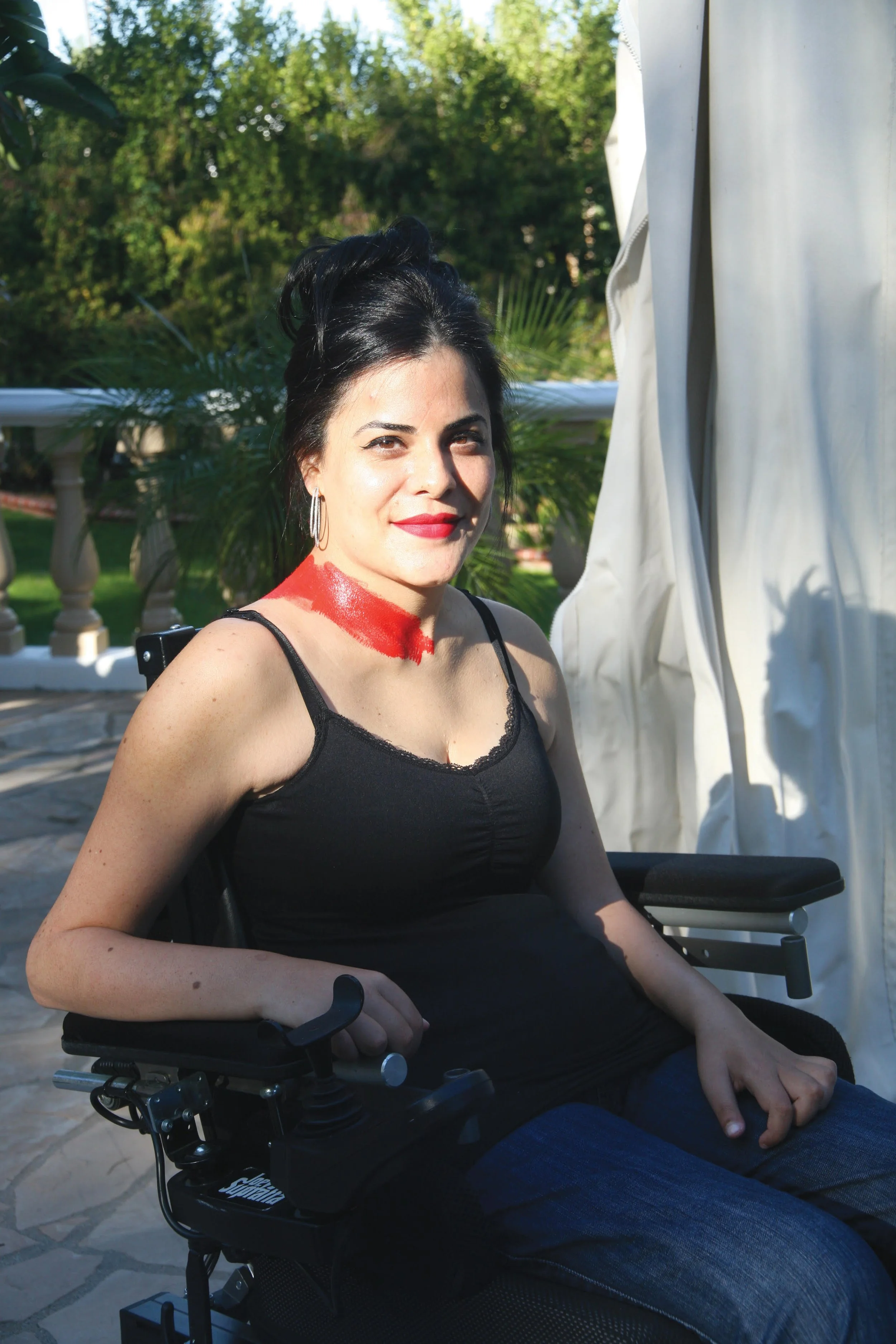 scarred for life.jpg