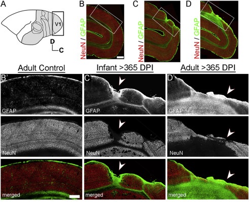 PUBLICATION IN NEUROBIOLOGY OF DISEASE