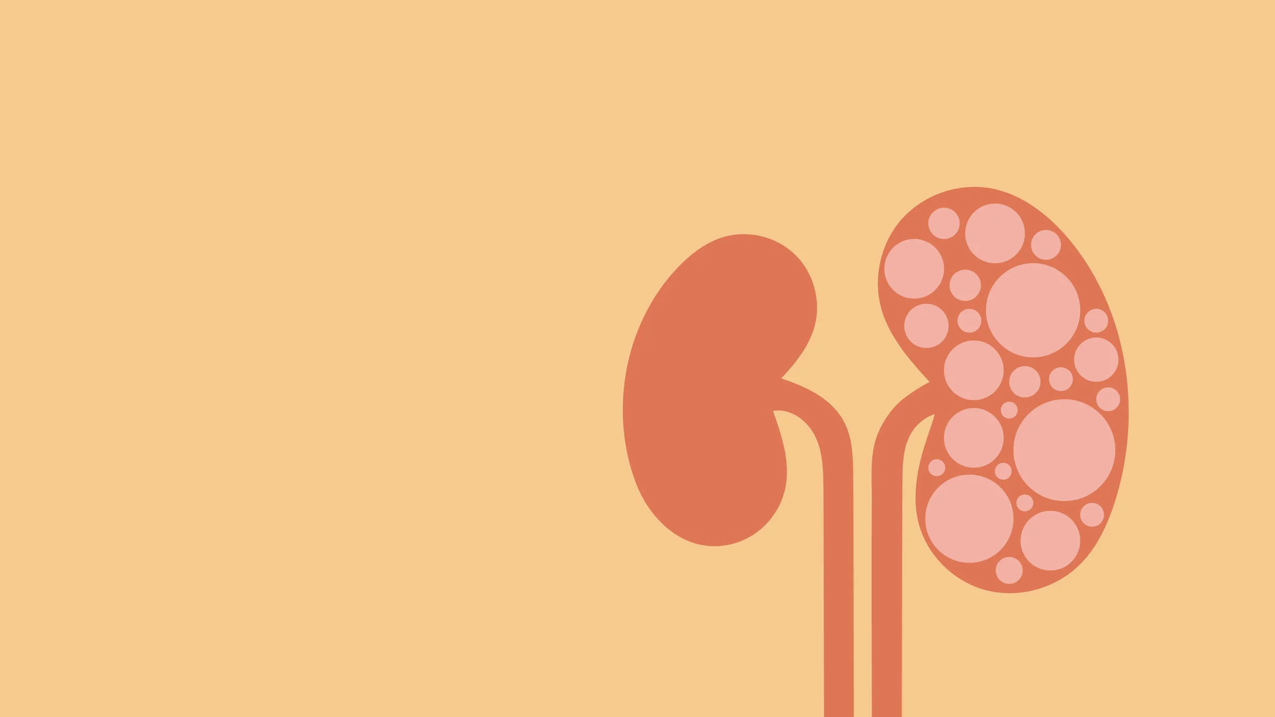 How Lettering Works is Supporting Kidney Disease Awareness in June
