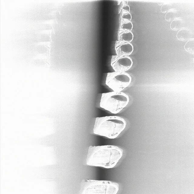 Darren Lawson Vs Vlure