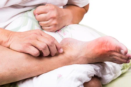 54524965_S-gout_toe_pain_big_man_pillow_foot.jpg