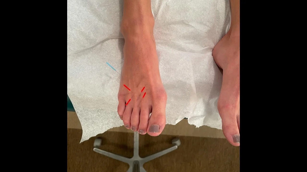 Blog — Lanier Therapy in Motion