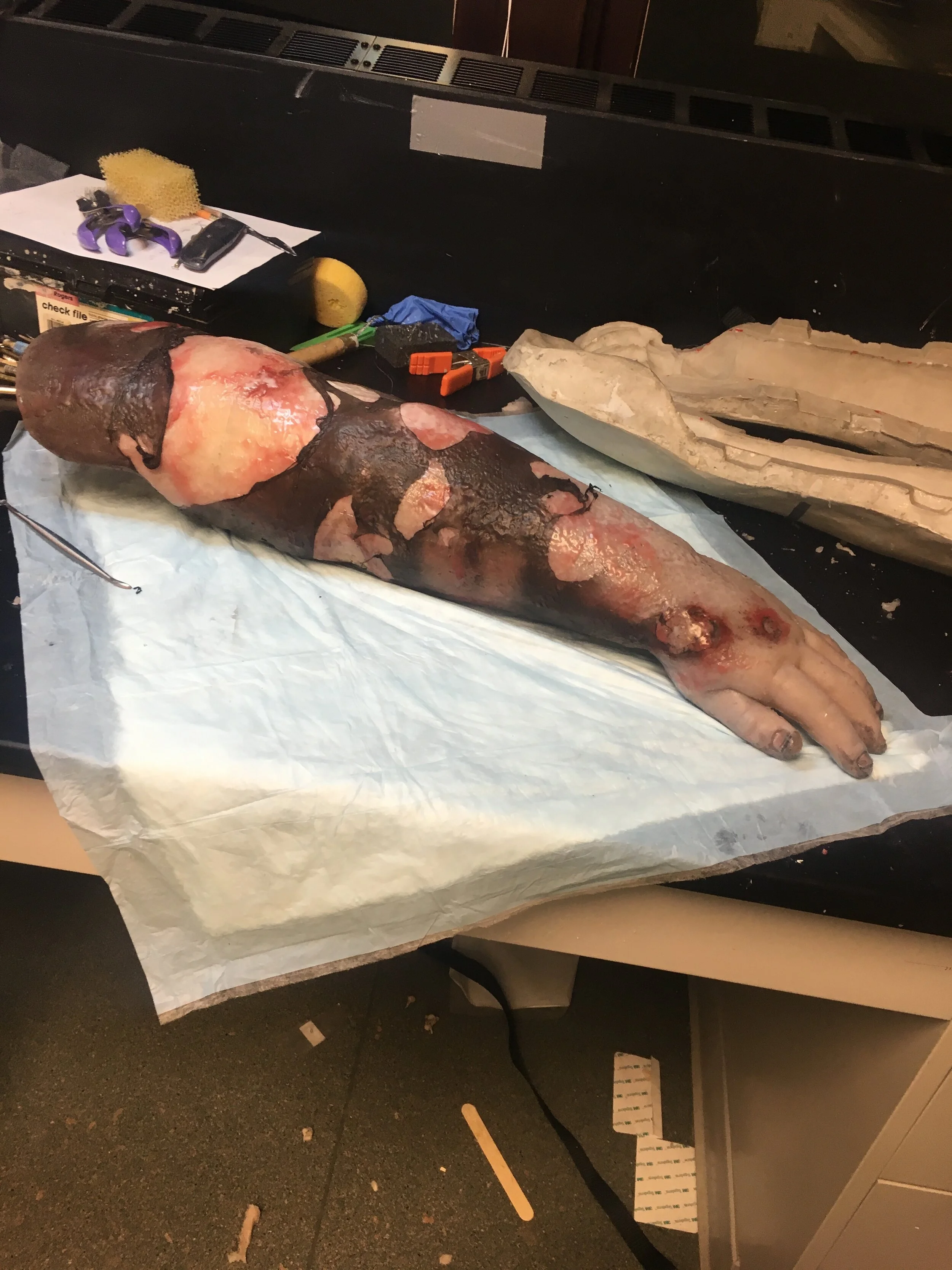 Escharotomy Surgery Simulator