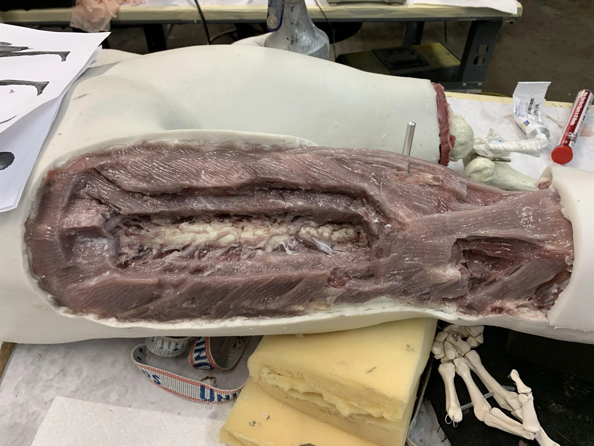 Silicone Fabricated Trauma