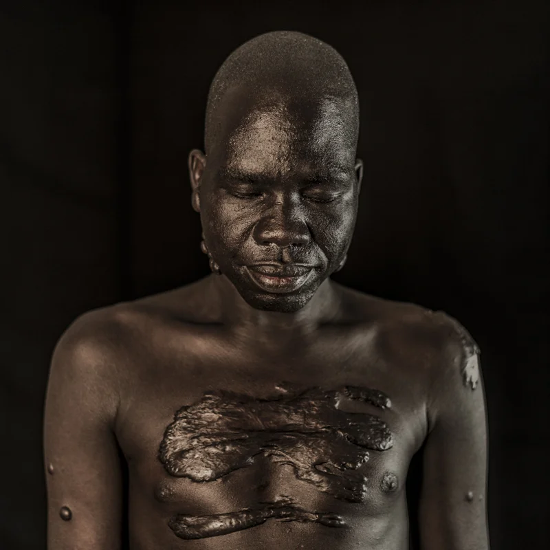 Joseph, former child soldier from South Sudan
