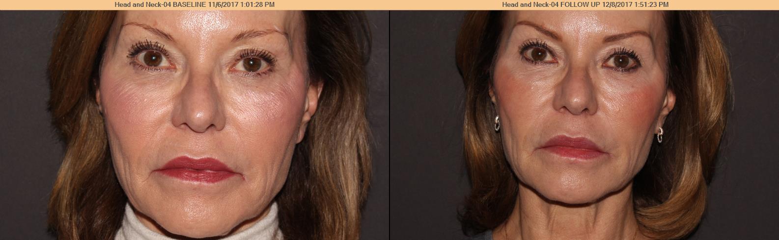 Susan_brows.jpg