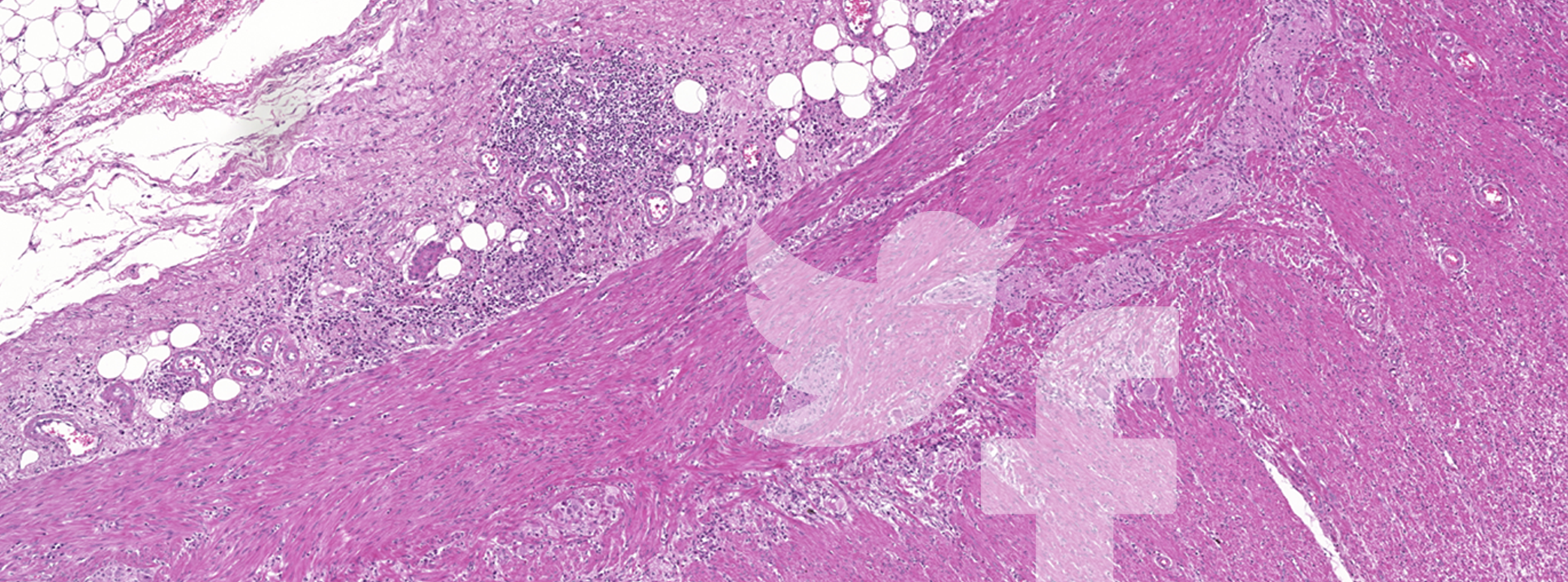 microDimensions_socialnetworkpathologist-header.png