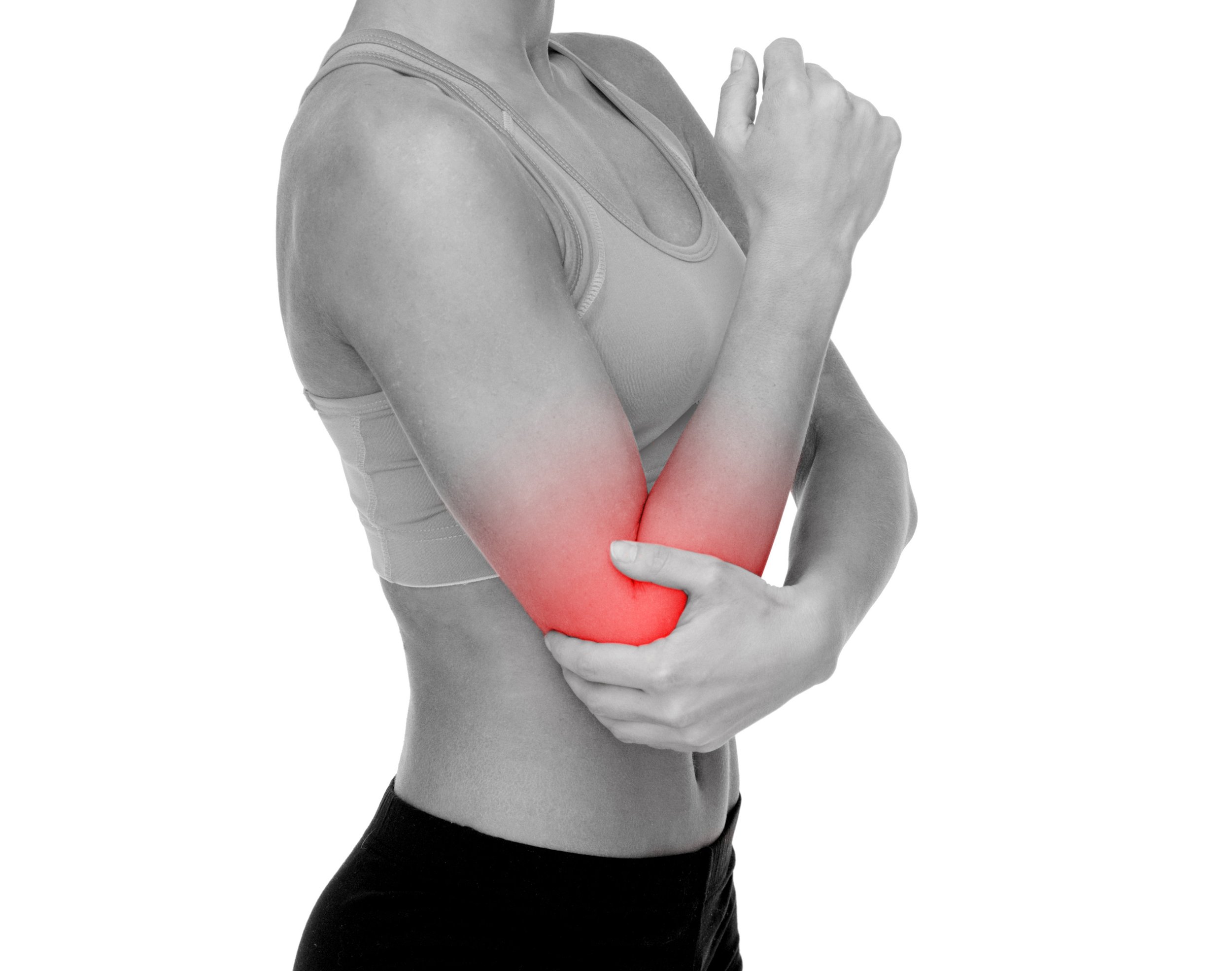 Radial Tunnel Syndrome