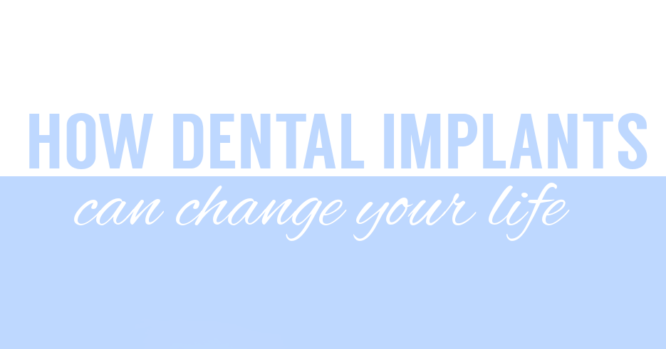dentalimplantslifechnge-copy