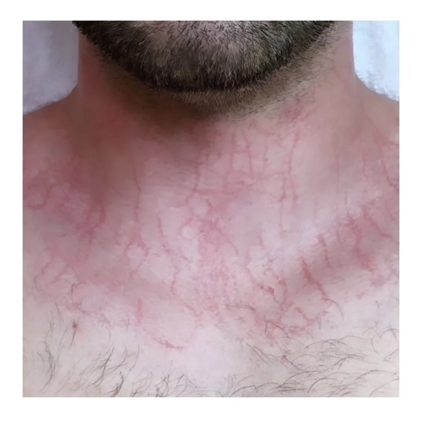 enzymes for skin