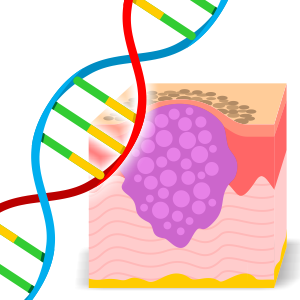 New genetic variants found to influence skin cancer risk