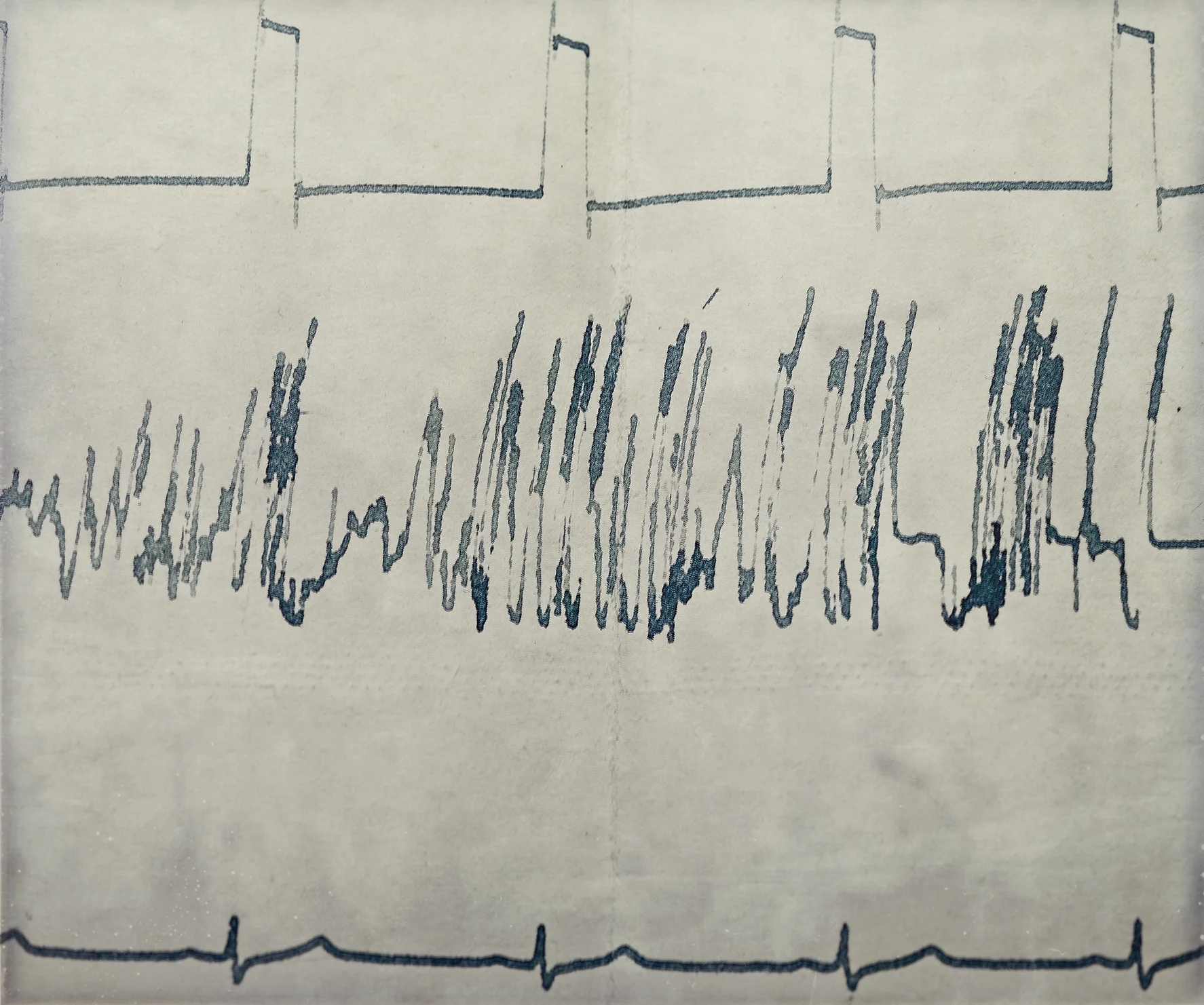 YURI GAGARINS ORIGINAL EKG, THE MOMENT HIS ROCKET LEFT THE LAUNCH PAD