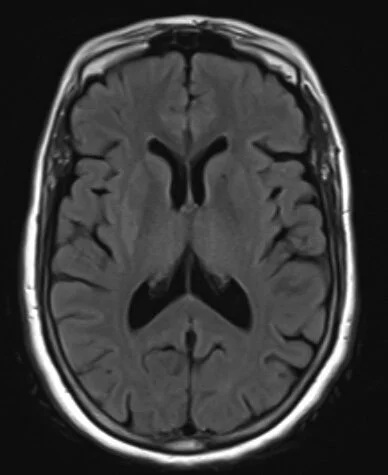 AACN-National Teaching Institute (NTI)