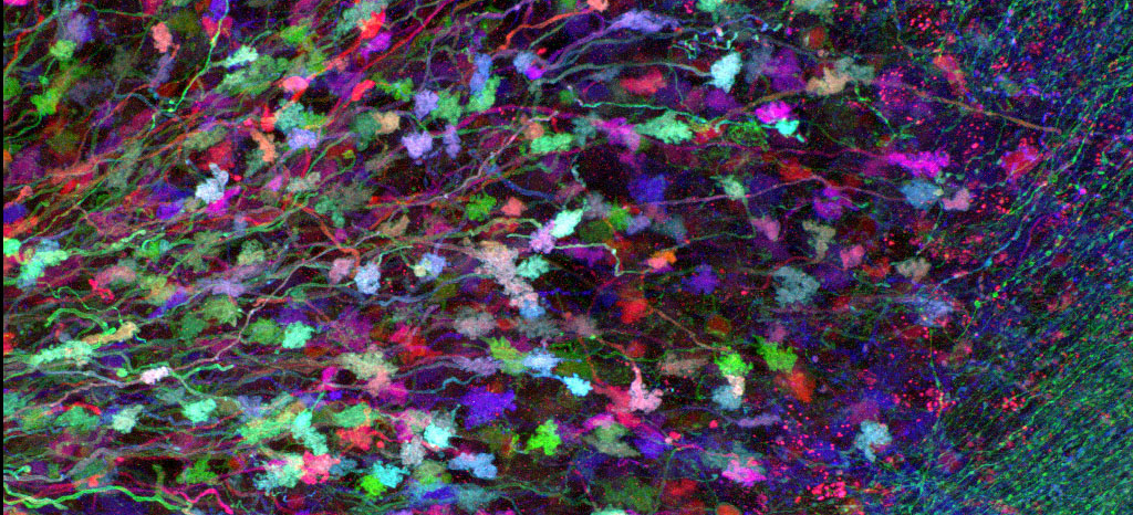 Brainbow_Cerebellum.png