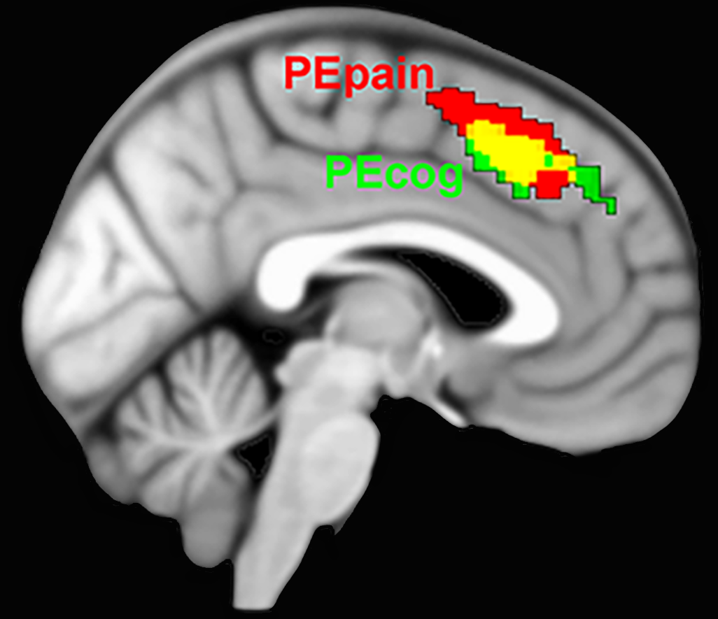 PE_cog_pain_labels.png