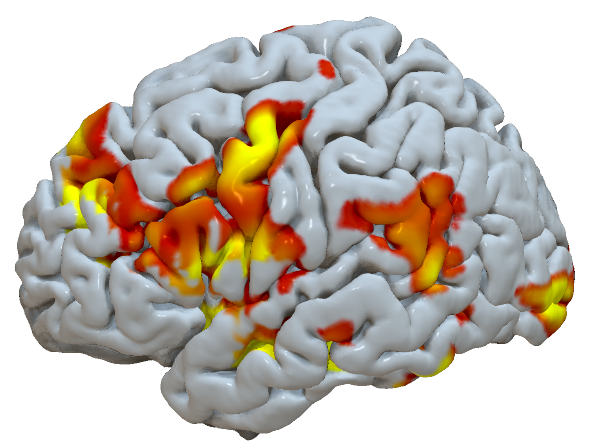 Andy s Brain Blog