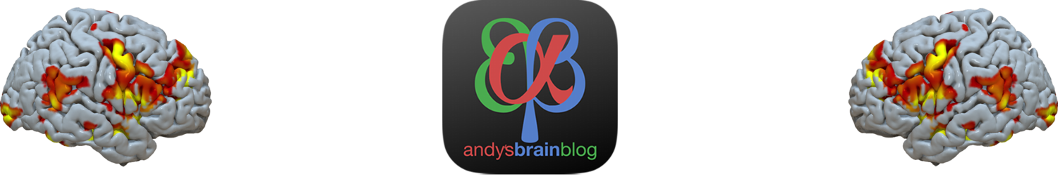 Andy's Brain Blog