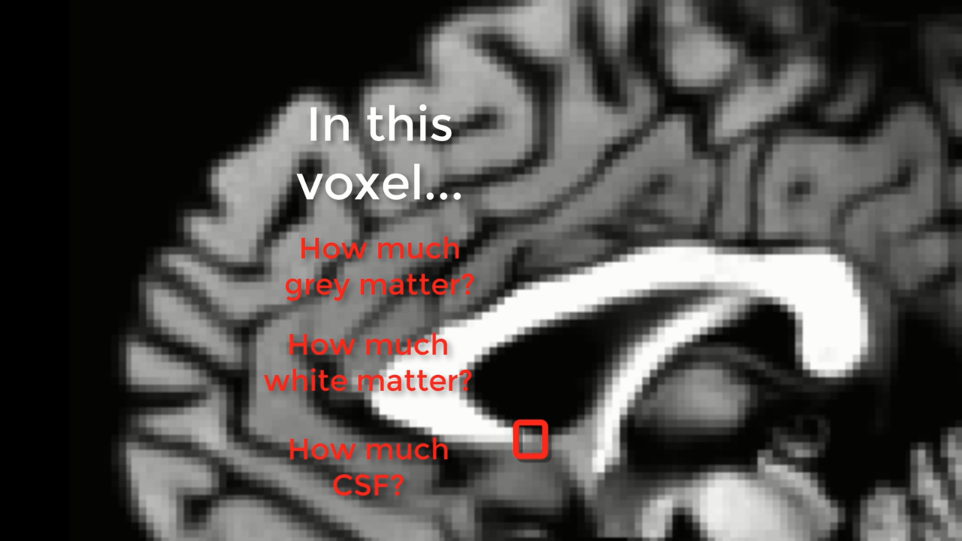 Figure 2: The partial voluming effect in a structural scan. The box highlighted in red represents a voxel that encompasses three different tissue types: White matter, grey matter, and CSF. If you imagine that the greyscale image is a real brain, and our red box is the smallest resolution element of our scan, the red box would be an average of the different tissue types contained within it.