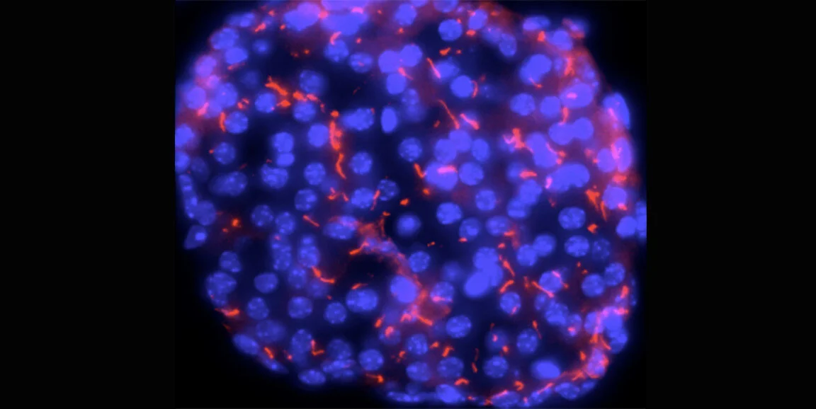 Diabetes, obesity and … the primary cilia?