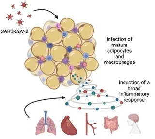 Stanford Medicine, Dr. Tracey McLaughlin study: SARS-CoV-2 infects fat tissue, creates inflammatory storm cloud