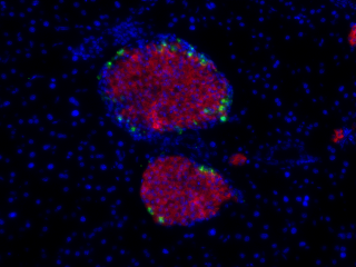 ‘Gentle’ islet cell transplant cures mice of diabetes with few side effects, Stanford Medicine researchers (Dr. Seung Kim) say