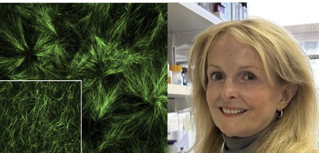 SDRC Investigator Natalie Torok Unveils New Insights on Liver Cancer Risk in Type 2 Diabetes Patients