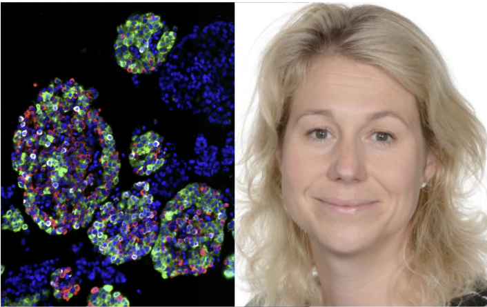 New Study from the NIH Integrated Islet Distribution Program and DRCs Reveals How Human Pancreatic Islet Cell Composition Shapes Diabetes Risk