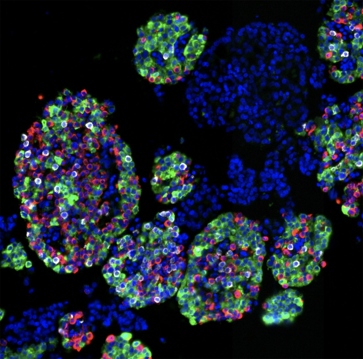 New Study from the NIH Integrated Islet Distribution Program and DRCs Reveals How Human Pancreatic Islet Cell Composition Shapes Diabetes Risk