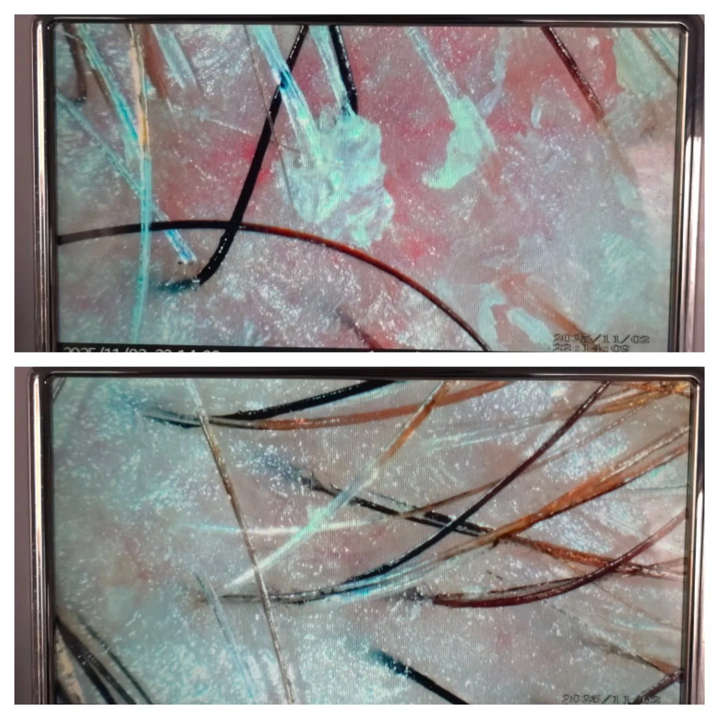 Scalp before &amp; after our Japanese Head Spa