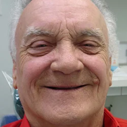 No teeth.