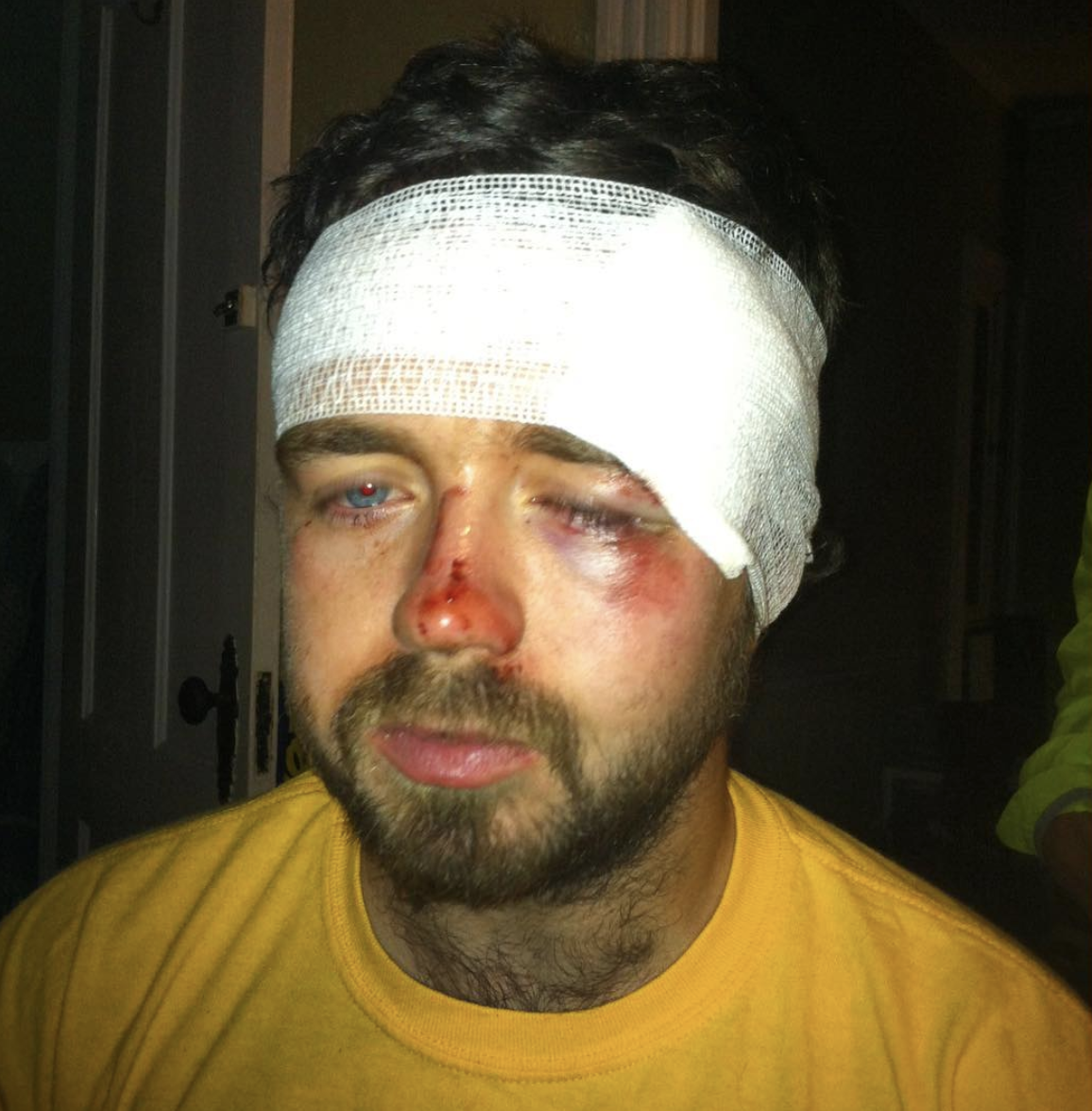 "Always be careful and mindful when biking!" #nofilter #fightclub #bikesafety
