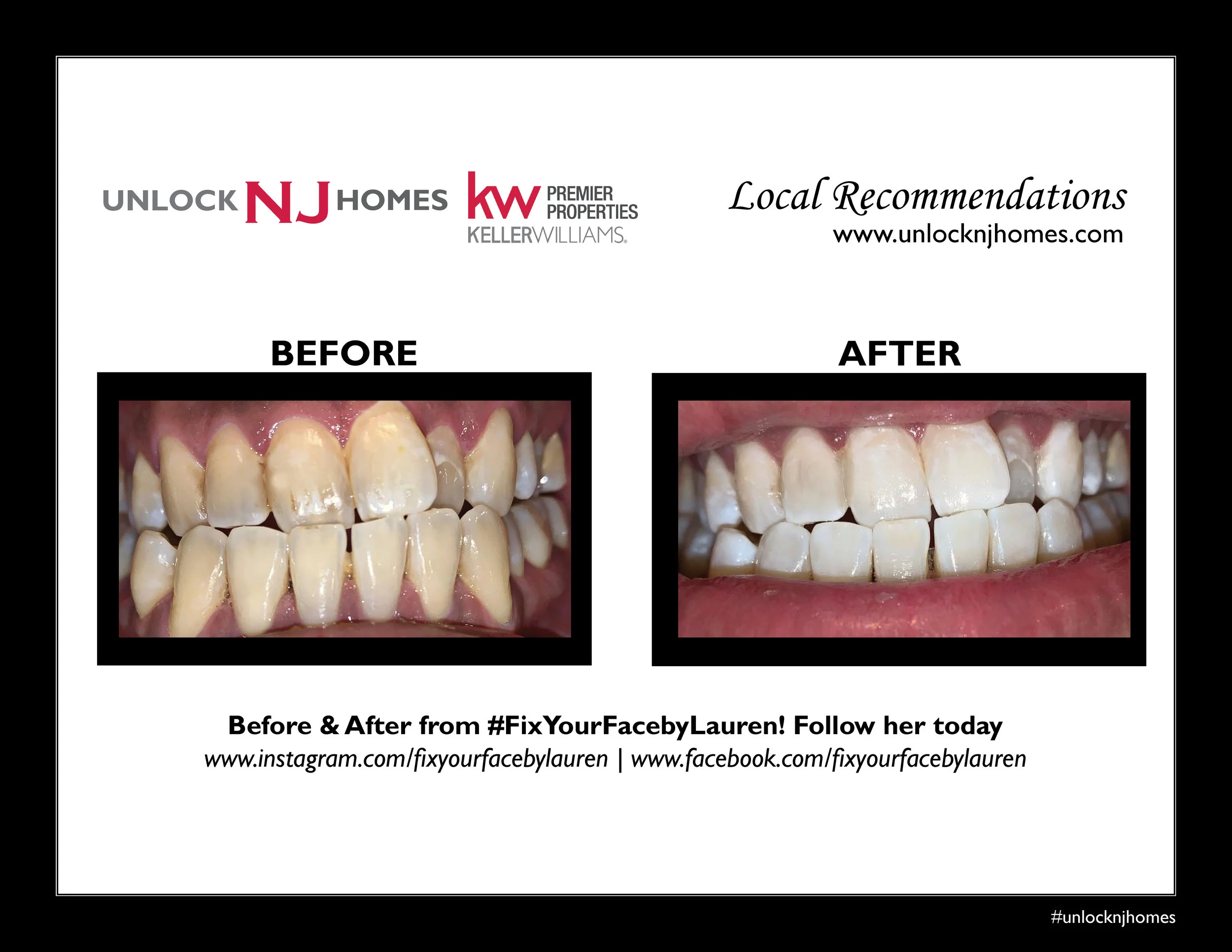 beforeandafterfixyourfacebylauren.jpg
