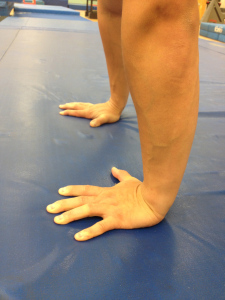 lys s Polar Mob TFCC Injury: the "meniscus tear" of the wrist — ACRO Physical Therapy &  Fitness