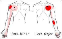 Typical referral pattern
