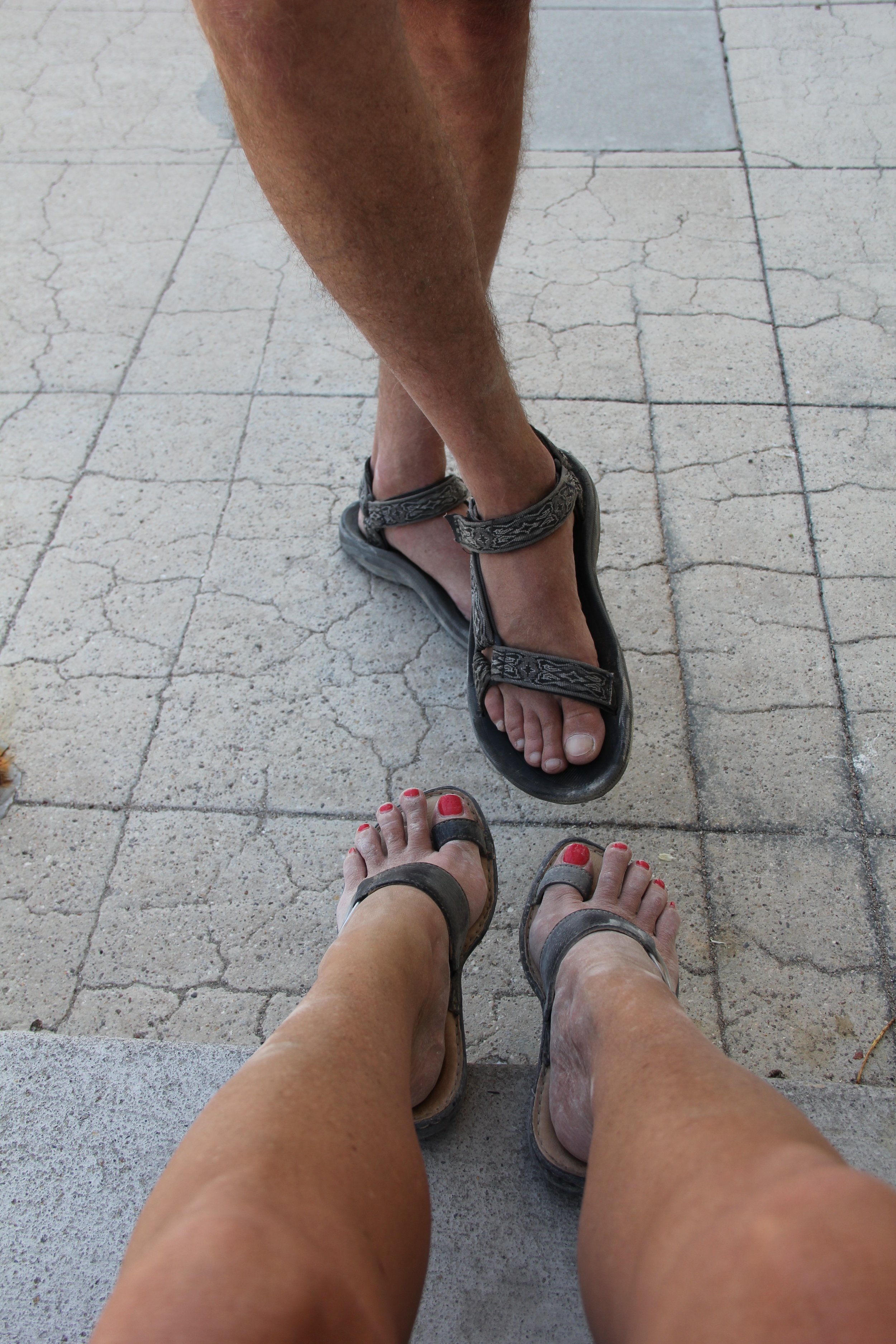 Miners Feet (My Dad Still Can't Believe I Mine In Sandals! 