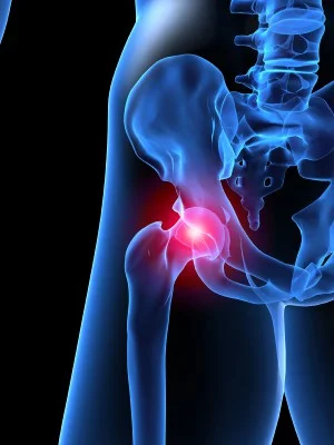 Injury-Hip1.jpg