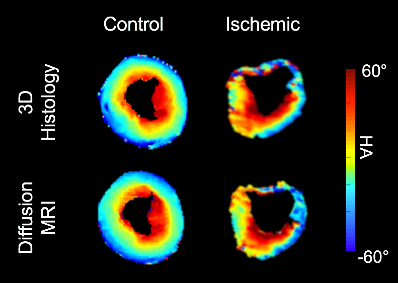 Histological Validation of DT-CMR with CLARITY and 3D Optical Imaging