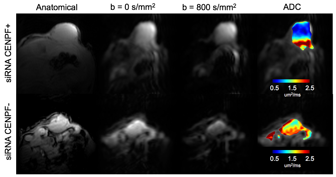 Modulation of DW-MRI in Human Prostate Tumor in Mice