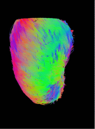 In vivo DT-CMR Tractography