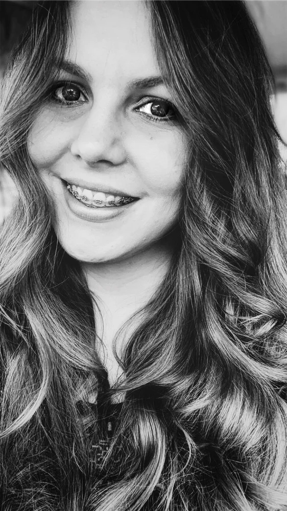 Lupus changed everything, even my hair