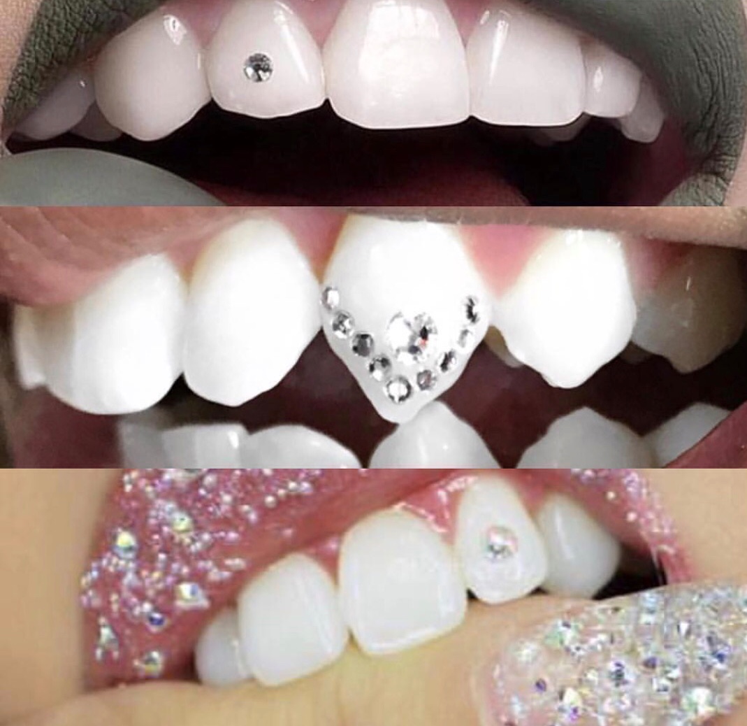 Tooth Gems London, Tooth Diamond, Teeth Gem